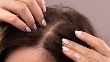 How to cover a bald spot