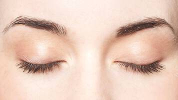 trichotillomania