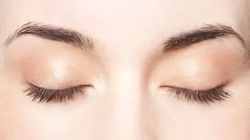 trichotillomania