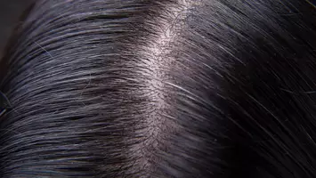 photo of woman's scalp with gray hair strands