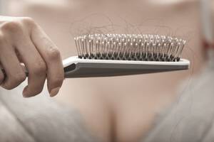 Photo of hair brush with lots of hair due to thinning hair