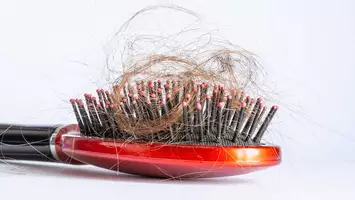 hair loss on brush