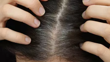 photo of grey hair growing into scalp