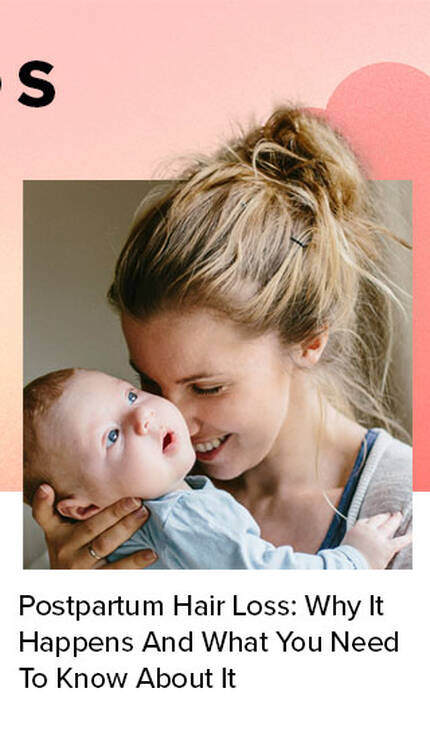 postpartum-hair-loss