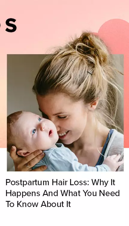postpartum-hair-loss