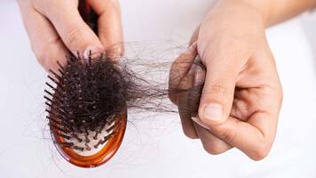 Women experiences hair loss after Covid diagnosis