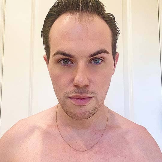 Men on how thinning hair affects their self confidence