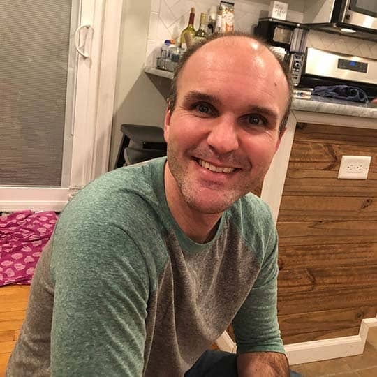 Men on how thinning hair affects their self confidence