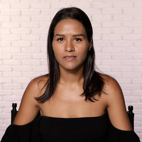 woman with medium length brown hair showing hairline